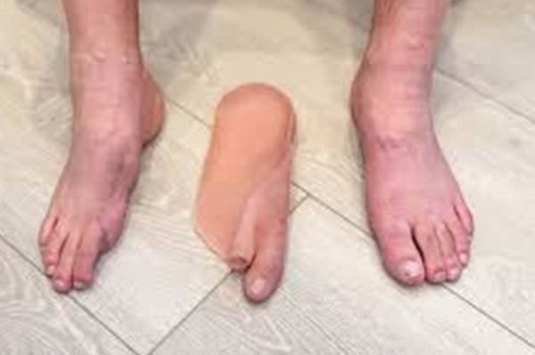 Silicone Body Part in Uttarakhand