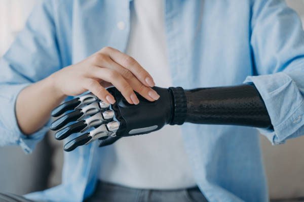 Upper Limb Implants in Jharkhand